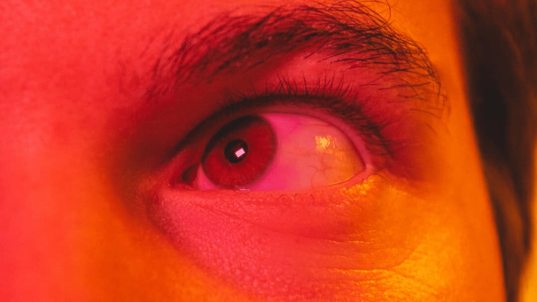 plano de saúde cobre blefaroplastia
