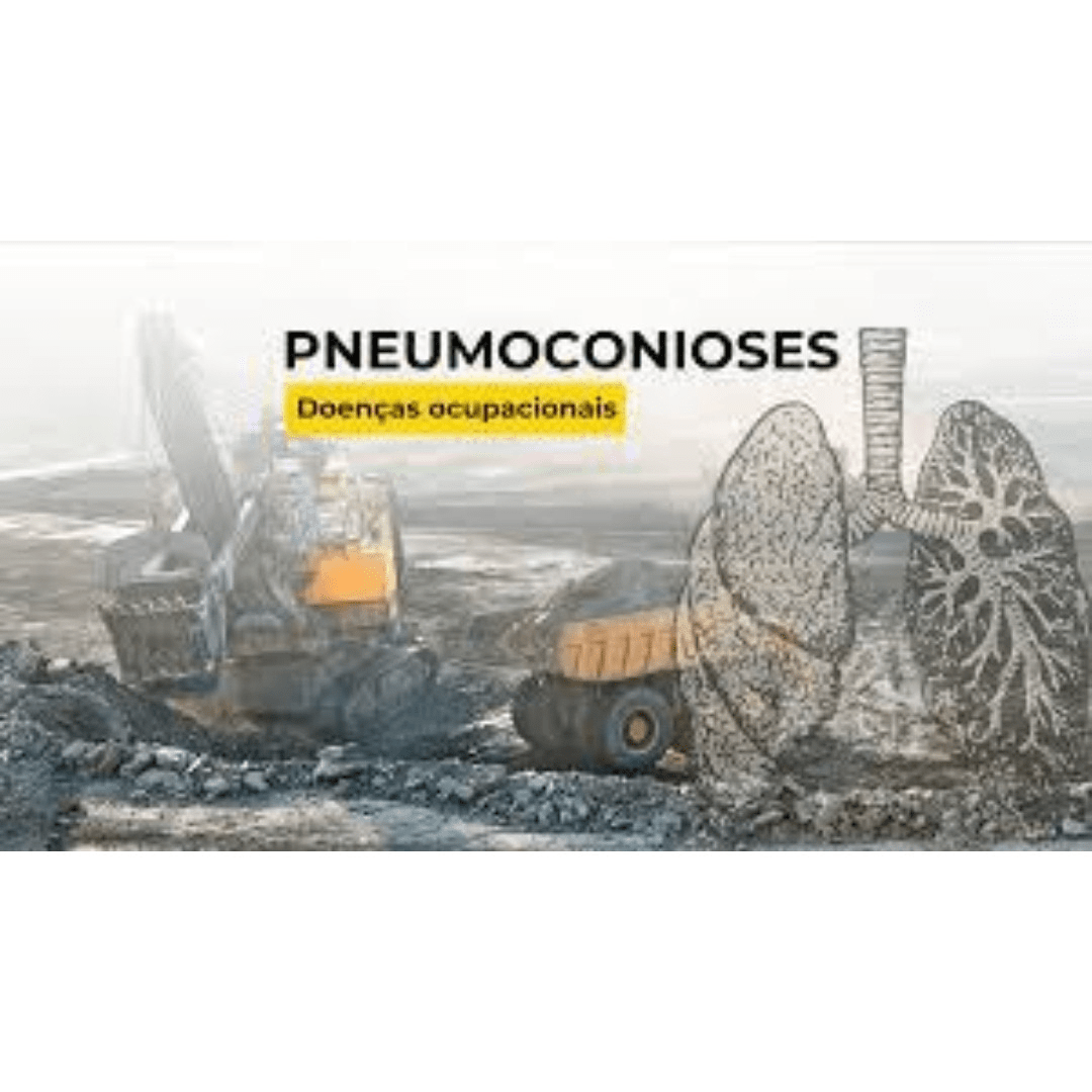 pneumoconioses relacionadas ao trabalho