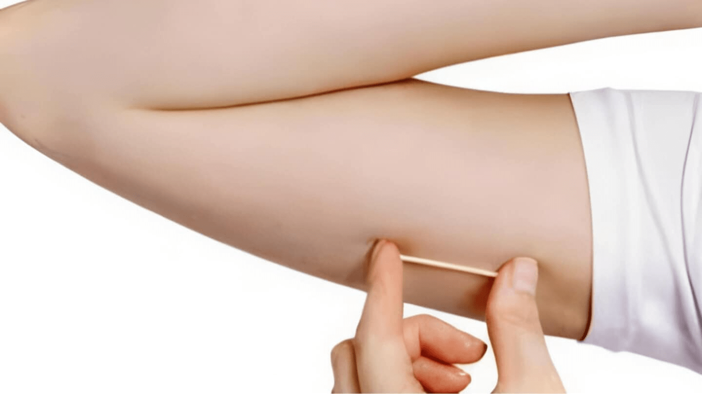 plano de saúde cobre implanon